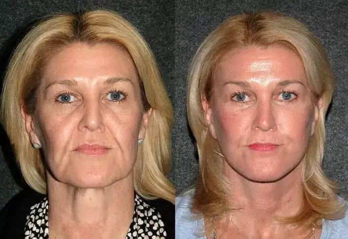 Mujer sufriendo de dolor de rodilla al levantarse