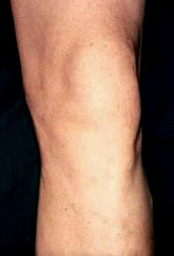 Rodilla saludable