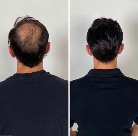 Mejora en el cabello